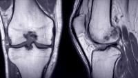 X-ray image of knee joints